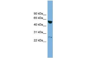 WB Suggested Anti-DEPDC7 Antibody Titration:  0. (DEPDC7 Antikörper  (N-Term))