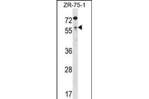 TCFL5 Antibody (C-term) (ABIN1537235 and ABIN2848658) western blot analysis in ZR-75-1 cell line lysates (35 μg/lane). (TCFL5 Antikörper  (C-Term))
