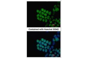 Immunofluorescence (IF) image for anti-SRY (Sex Determining Region Y)-Box 2 (SOX2) antibody (ABIN2855074)