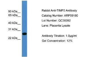 WB Suggested Anti-TIMP2  Antibody Titration: 0. (TIMP2 Antikörper  (N-Term))
