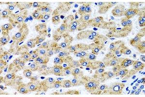 Immunohistochemistry of paraffin-embedded Human liver using SERPINA7 Polyclonal Antibody at dilution of 1:100 (40x lens). (SERPINA7 Antikörper)