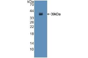 Detection of Recombinant ISR, Human using Polyclonal Antibody to Insulin Receptor (INSR) (Insulin Receptor Antikörper  (AA 1027-1364))