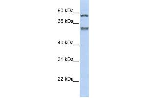 WB Suggested Anti-TRIM50 Antibody Titration:  0.