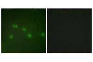 Immunofluorescence analysis of HUVEC cells, using COT2 antibody. (NR2F2 Antikörper  (N-Term))
