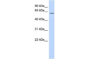 Western Blotting (WB) image for anti-Transmembrane Protein 209 (TMEM209) antibody (ABIN2460092) (TMEM209 Antikörper)