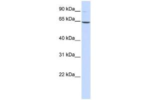 WB Suggested Anti-LTA4H Antibody Titration: 0. (LTA4H Antikörper  (Middle Region))