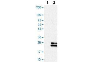 Western blot analysis of Lane 1: Negative control (vector only transfected HEK293T lysate), Lane 2: Over-expression Lysate (Co-expressed with a C-terminal myc-DDK tag (~3. (Relaxin 3 Antikörper)