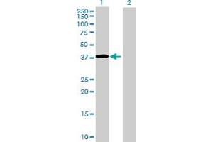 Western Blot analysis of MECR expression in transfected 293T cell line by MECR MaxPab polyclonal antibody. (MECR Antikörper  (AA 1-373))