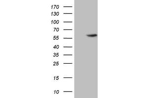 Western Blotting (WB) image for anti-4-Aminobutyrate Aminotransferase (ABAT) (AA 29-323) antibody (ABIN2715601) (ABAT Antikörper  (AA 29-323))