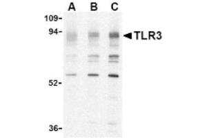 Image no. 1 for anti-Toll-Like Receptor 3 (TLR3) (N-Term) antibody (ABIN265140) (TLR3 Antikörper  (N-Term))