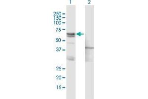 Western Blot analysis of ASNS expression in transfected 293T cell line by ASNS MaxPab polyclonal antibody.