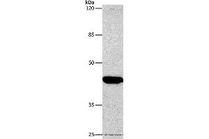 Western blot analysis of Hela cell, using CTGF Polyclonal Antibody at dilution of 1:850 (CTGF Antikörper)