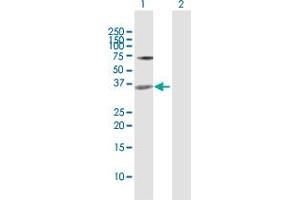 Western Blot analysis of MEOX2 expression in transfected 293T cell line by MEOX2 MaxPab polyclonal antibody. (MEOX2 Antikörper  (AA 1-303))