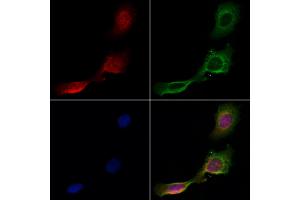 ABIN6261240 and ABIN6266855 staining Hela cells by IF/ICC.