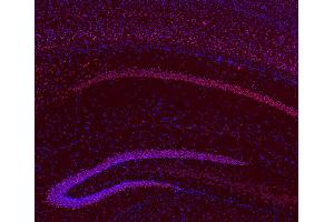 Indirect immunostaining of PFA fixed, paraffin embedded mouse brain section (dilution 1 : 200; red). (BCL11B Antikörper  (AA 541-812))