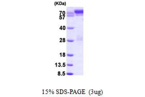 STAT1 Protein (AA 1-712) (His tag)