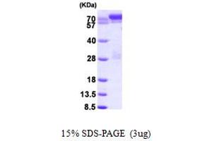 SDS-PAGE (SDS) image for Signal Transducer and Activator of Transcription 1, 91kDa (STAT1) (AA 1-712) protein (His tag) (ABIN667813) (STAT1 Protein (AA 1-712) (His tag))