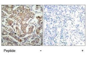 Image no. 1 for anti-BCL2-Associated Agonist of Cell Death (BAD) (Ser155) antibody (ABIN197213) (BAD Antikörper  (Ser155))