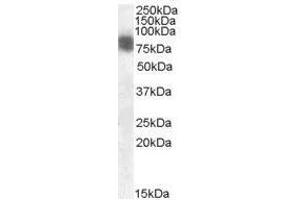 Image no. 1 for anti-Cortactin (CTTN) (N-Term) antibody (ABIN374140) (Cortactin Antikörper  (N-Term))