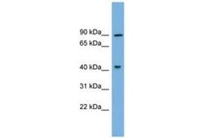 Image no. 1 for anti-Dual-Specificity tyrosine-(Y)-phosphorylation Regulated Kinase 1A (DYRK1A) (AA 107-156) antibody (ABIN6743391) (DYRK1A Antikörper  (AA 107-156))