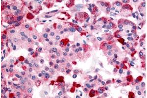 Anti-TRPM4 antibody  ABIN1049433 IHC staining of human pancreas. (TRPM4 Antikörper  (Internal Region))