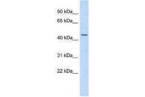 WB Suggested Anti-KRT24 Antibody Titration: 0.