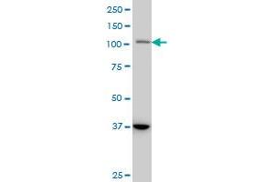 STAT2 monoclonal antibody (M01), clone 5G7 Western Blot analysis of STAT2 expression in A-431 . (STAT2 Antikörper  (AA 742-851))