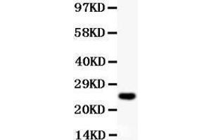 Anti-Cyclin D3 Picoband antibody,  All lanes: Anti Cyclin D3  at 0. (Cyclin D3 Antikörper  (AA 136-292))
