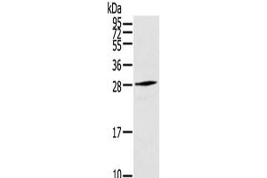 Western Blot analysis of Human fetal muscle tissue using THYN1 Polyclonal Antibody at dilution of 1/800 (THYN1 Antikörper)