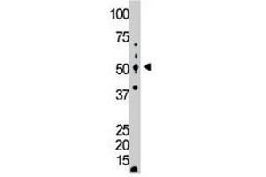 The GCK polyclonal antibody  is used in Western blot to detect GCK in mouse lung tissue lysate. (GCK Antikörper  (C-Term))