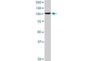 CDH1 MaxPab rabbit polyclonal antibody. (E-cadherin Antikörper  (AA 1-882))