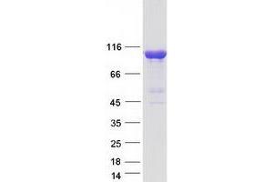 Western Blotting (WB) image for Inositol Polyphosphate-4-Phosphatase, Type I, 107kDa (INPP4A) (Transcript Variant B) protein (Myc-DYKDDDDK Tag) (ABIN2723480)