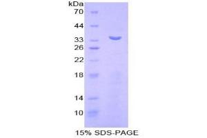 SDS-PAGE analysis of Mouse Matrix Metalloproteinase 7 (MMP7) Protein.