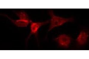 Immunofluorescence (fixed cells) (IF/ICC) image for anti-Angiotensin II Receptor, Type 1 (AGTR1) (N-Term) antibody (ABIN6256893)