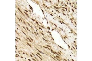 Immunohistochemistry of paraffin-embedded human leiomyoma of uterus using ANP32A Antibody. (PHAP1 Antikörper  (AA 1-170))
