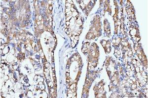 IHC analysis of DHODH using anti-DHODH antibody (ABIN7603139). (DHODH Antikörper  (N-Term))