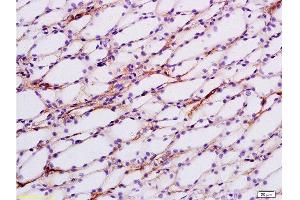 Formalin-fixed and paraffin embedded rat kidney tissue labeled with Anti-ENaCg/γENaC Polyclonal Antibody, Unconjugated at 1:200 followed by conjugation to the secondary antibody and DAB staining (SCNN1G Antikörper  (AA 188-290))
