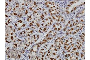 Immunoperoxidase of monoclonal antibody to WWP1 on formalin-fixed paraffin-embedded human stomach. (WWP1 Antikörper  (AA 152-260))