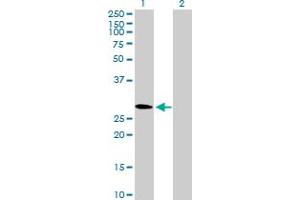 Western Blot analysis of CMTM2 expression in transfected 293T cell line by CMTM2 MaxPab polyclonal antibody. (CMTM2 Antikörper  (AA 1-248))
