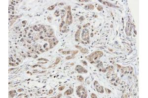 IHC-P Image Immunohistochemical analysis of paraffin-embedded A549 xenograft, using ARPC1A, antibody at 1:100 dilution. (ARPC1A Antikörper  (N-Term))