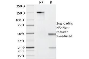 SDS-PAGE Analysis Purified Granzyme B Mouse Monoclonal Antibody (GZMB/2403). (GZMB Antikörper  (AA 73-187))