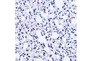 Immunohistochemistry of paraffin-embedded rat lung using POLR2A Rabbit pAb (ABIN6130298, ABIN6145914, ABIN6145915 and ABIN6215095) at dilution of 1:50 (40x lens).
