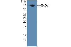 Figure. (PKC theta Antikörper  (AA 380-634))