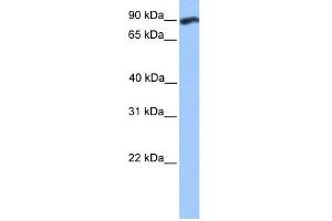 WB Suggested Anti-WDFY3 Antibody Titration:  0.