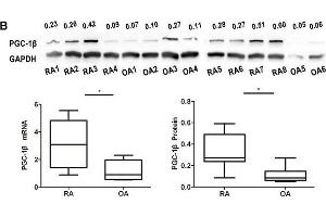 Expression of peroxisome proliferator-activated receptor-gamma coactivator-1 β (PGC-1β) is over-expressed in rheumatoid arthritis (RA)-fibrolast-like synoviocytes (FLS). (PPARGC1B Antikörper  (AA 901-1023))