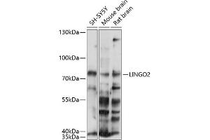 Western blot analysis of extracts of various cell lines, using LINGO2 antibody (ABIN7268216) at 1:1000 dilution. (LINGO2 Antikörper  (AA 370-540))