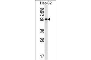 Western blot analysis in HepG2 cell line lysates (35ug/lane). (UGDH Antikörper  (C-Term))