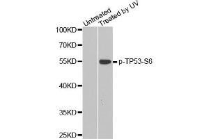 Western Blotting (WB) image for anti-Tumor Protein P53 (TP53) (pSer6) antibody (ABIN1870678) (p53 Antikörper  (pSer6))