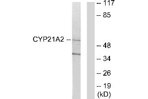 Western blot analysis of extracts from 293 cells, using Cytochrome P450 21A2 antibody. (CYP21A2 Antikörper)