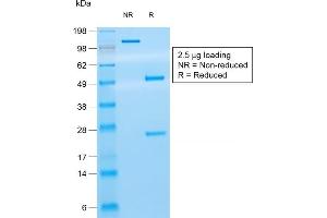 SDS-PAGE Analysis Purified CD8 Mouse Recombinant Monoclonal Antibody (rC8/468). (Rekombinanter CD8 alpha Antikörper)